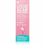 MomCare by Lina C-Section Silicone Scar Patches silikoonplaastrid keisril&otilde;ikearmidele suurus L-XL 5 x 20 cm 3 tk