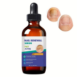 Extra Tugevus Varbak&uuml;&uuml;nte Hooldus Seerum - 30ml | Niisutav K&uuml;&uuml;nte Uuendamise Lahus Tugevatele, Tervetele Varbak&uuml;&uuml;ntele