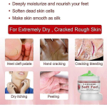 Jalakreemi antifriisi, pesemisvastane, niisutav, taastamine, kuiv, peeling_an_as pilt