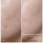 Babor Ampoule Concentrate Active Purifier Iluampullid probleemsele nahat&uuml;&uuml;bile, 7x2ml