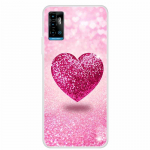 ZTE Blade A71 &uuml;mbrise jaoks luksuslik kaitseraua silikoonist TPU pehme kattega telefoni&uuml;mbris ZTE Blade A7s 2020 p&otilde;rutuskindlale Cartoon Coque Funda jaoks ZTE Blade A71