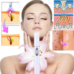 Pehme armieemaldaja akne laserpliiats, sinine valgusteraapia, kaasaskantav kortsude eemaldamise masin veenilaiendite ravi massaažiga l&otilde;dvestu