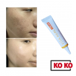 [CHAKAN] Vita Real kreem (Helgendamine ja valgendamine) 15 ml tedret&auml;hnide parandamiseks 15ml x 1