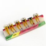1 tk Hambahammaste mudel Periodontal Disease Assort Hammaste klassifikatsiooni mudel Typodont Dental Teaching Display Model 1 piece A