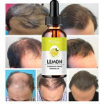 Nahahooldus eeterlik &otilde;li massaaž toitev nahaessents valgendav helendav survet leevendav niisutav eeterlik &otilde;li 5ml