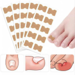 K&uuml;&uuml;nte korrigeerimise kleebised Korrigeerimisplaastrid Mittekleepuvad Sissekasvanud Varbak&uuml;&uuml;ned Korrigeerivad Plaastrid Pedik&uuml;&uuml;r T&ouml;&ouml;riistad Jalahooldus Remont 60pcs(6 sheets)