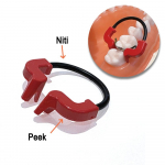 1 tk v&otilde;i 2 tk v&otilde;i 3 tk hambaravi kontuuriga maatriksite klambrir&otilde;ngas koos PEEK maatriksis&uuml;steemi komplektiga Matrix Bands Wedge Painduvad NITI materjalid 2 pieces red