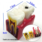 1 tk hambaanatoomia haridusega hambamudel 6-kordse kaariese v&otilde;rdlusuuringu mudelid hambaarstide &otilde;ppimiseks ja uurimiseks 1 piece B