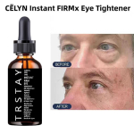 Ajutine silmakottide eemaldamise kreem silmaalust koheselt pinguldav ja pinguldav silmakreem t&otilde;stab ja pinguldab silmanahka tumedate ringide jaoks 15ml