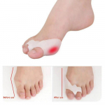 Silikoongeelist jalavarbad Kahe auguga varvaste eraldaja p&ouml;idla Valguse kaitsja Bunion Hallux Valguse kaitsejalgade kattuv padjandi sisestus 2 tk 2pcs valge