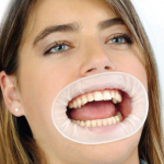 5pcs Disposable cheap Dental Rubber mouth gag cheek retractor for dental use valge
