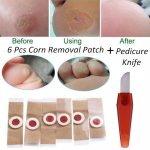 6 tk/komplekt Foot Corn Removal Killer Calluses Plantar