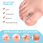 Toe Splitter Corrector Big Foot Bone Orthosis Clip Toe Pad Toe Over