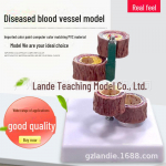 Neljaastmeline vaskulaarse skleroosi ja tromboosi mudel