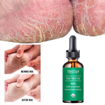 Jalgade ravi: Botanical Foot Lotion niisutav jalahooldusessents kuivale nahale, l&otilde;henenud kontsadele, tugev tervendav j&otilde;ud, seenevastane 5ml
