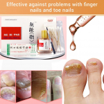 K&uuml;&uuml;net&ouml;&ouml;riistad K&uuml;&uuml;net&ouml;&ouml;riistad Moodne k&uuml;&uuml;nte parandamise essence Moisturize Art Care Toiteaine kuivadele l&otilde;henenud k&uuml;&uuml;nenaha k&uuml;&uuml;nte hooldus K&uuml;&uuml;nte t&ouml;&ouml;riistad