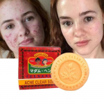 Seep - Madame Heng - Eriline akne - 150g - Segakasutus - Akne kontroll