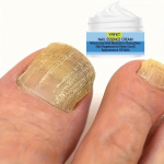 Super Nail Care Cream - No Fragrance, Gentle Formula, Suitable for Normal and Sensitive Skin, Multi functional, Used for Toe and Nail Problems 5G