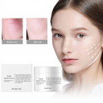 345 Rahustav Kreem 50g 345 Kreem V&auml;hendab Punetust ja Toitev Niisutaja Sobib Aknele ja Rasusele Nahale Sobib K&otilde;ikidele Nahat&uuml;&uuml;pidele One Size valge