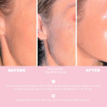 Juuste tuvastussprei n&auml;o raseerimiseks, Nahale ja kehale m&otilde;eldud Dermaplane sprei naistele koos 3 raseerijaga, Villi eemaldamine dermaplaninguks, N&auml;osprei