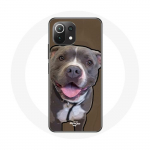 Xiaomi Mi 11 Lite Pitbull Dog &uuml;mbris, valge hall