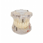 Eemaldatav hammaste mudel implantaat haigus hambaarst &otilde;ppimine uus hambaravi mudel hambad implantaat taastamine sild &otilde;petus demonstratsioon puhas