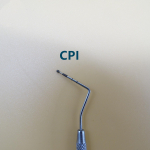 M&uuml;&uuml;a kvaliteetsed hambaraviinstrumendid ja sondid CPI