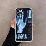 Armas animatsioonimoodne pehme telefon Iphone 8 XS 13 Plus Max 12 Mini 14 6s 7 Pro 11 X XR 6 silikoonist TPU korpuse kate for Iphone 11