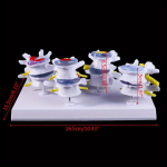 Meditsiinilise rekvisiidi mudel 1 komplekt Inimese nimmepiirkonna kahjustuse l&uuml;lisamba kujude n&auml;idiku mudel Meditsiini&otilde;ppe &otilde;ppevahend a set