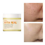 Glutathione blemishes, pigmentation, blemishes, age spots, freckles, moisture, moisturizing whitening pad, 1 piece, 1 piece beige