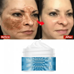 H&uuml;aluroonhappe essentsikreem Niisutav Toitekreem V&auml;hendab Kortse Nahka kirgastav N&auml;okreem N&auml;onahahooldus 5g