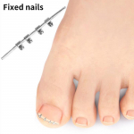 1 tk sissekasvanud varbak&uuml;&uuml;ne korrigeerimise t&ouml;&ouml;riist n&auml;htamatu sissekasvanud varba k&uuml;&uuml;nte elastne sirgendamine klambriga pedik&uuml;&uuml;ri t&ouml;&ouml;riist