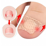 Sissekasvanud varbak&uuml;&uuml;ne varvaste korrigeerimise kleebised Nail Art Jalaplaastrid Jalahooldus Paron&uuml;&uuml;hia ravi Taastav pedik&uuml;&uuml;r jalat&ouml;&ouml;riist 12Pcs