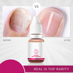 10 ml k&uuml;&uuml;neseerum l&otilde;henenud ja kahjustatud k&uuml;&uuml;nte k&uuml;&uuml;nenaha jaoks efektiivne k&uuml;&uuml;neseerum One Size