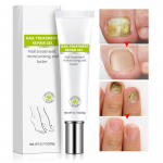 1/3/5/10 tk k&uuml;&uuml;nte parandamine toitev Brighten Foot Finger Care k&uuml;&uuml;neseerum k&uuml;&uuml;nekreem Naiste meeste k&uuml;&uuml;ned tooted