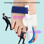 2 tk Bunion Corrector naistele Universaalsed naiste varvaste lahased varvaste eraldajad kattuva suure varba jaoks