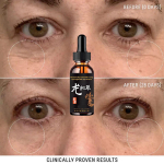Niisutav n&auml;okreem kortsude ja peente joonte vastu pinguldav silmakreem 5ml