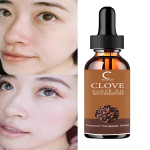 Catfit Natural Rose Essential Oil Relaxes SPA Body Oil niisutav pinguldav naha&otilde;li Improve Sleeping YOGA Skincare Massage Oil 5ml