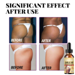 5ML/15ML/30ML/50ML/Kasvata oma tagumikku suurendav kreem Eeterlikud &otilde;lid Essence Lifts Firm Tuharad Lordosis Butt Lifts TuharadZ 5ml