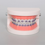 1 tk Hambaravi Ortodontilise Ravi Hammaste Mudel Klambriga Kaaretraat Bukkaaltoru Ligatuursidemed Hambaarsti Labor Hamba Mudel &Otilde;ppevahendid valge