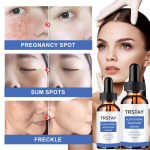 5G/15G/30G/50G/TRSTAY k&otilde;rgniisutav n&auml;okreem niisutav, niisutav, parandav, rahustav losjoon nahahooldus 5ml