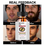 Beard Growth Oil Spray Kiire juuksekasvu eeterlikud &otilde;lid essentsseerum paksema habeme jaoks, niisutav juuksekasvu&otilde;li 5ml