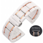Keraamiline kellarihm 14mm 15 16 17 18mm 20mm 22mm kellarihm huawei Ticwatch kelladele naiste meeste moe k&auml;ekellade rihm 18mm