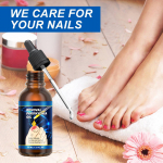 Nail Grooves Oil 30ml Nail Grooves Sissekasvanud K&uuml;&uuml;nte P&otilde;letik S&auml;ilitab k&uuml;&uuml;nte Tervist Pehmendav Nail Grooves &Otilde;li One Size