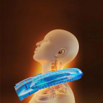 for Neck And Shoulders, Heat Bag with Removable Washable Cover roosa