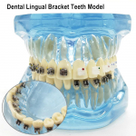 1 tk hambaortodontiline hambamudel keeleklambriga keraamiliste ja metallklambritega patsientide suhtlemiseks hambaravi uurimiseks m&otilde;eldud hambavorm 1 piece