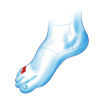 Silikoonist varbakaitse ja varvaste eraldaja Mazbit Separator Duo Mini, 2 t&uuml;kid