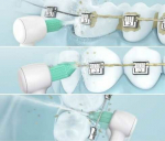 Panasonic WEW 0984 W 303 Orthodontic nozzle