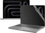 PanzerGlass Dual Privacy - Privacy Filter for Notebook - 40.6 cm (16")