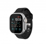 KeyBudz Reis Apple Watchi kinnitus - Kohvablaanet